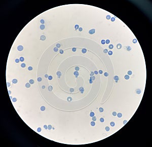 Reticulocytes is red blood cell immature photo