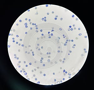 Reticulocytes are red blood cells that are still developing photo