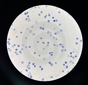 Reticulocytes are red blood cells that are still developing photo