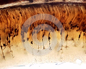 Retina. Golgi method. Bipolar cells photo