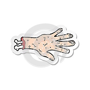 retro distressed sticker of a gross severed hand cartoon