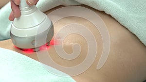 Rf skin tightening, belly.