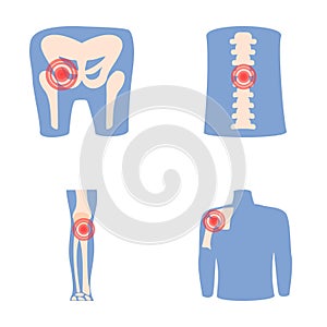 Rheumatism icons set cartoon vector. Human joint with pain ring