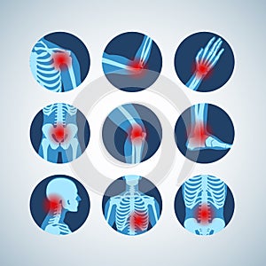 Rheumatism or rheumatic disorder medical set. Arthritis joint pain. Rheumatology vector infographics photo