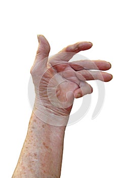 Rheumatoid Arthritis