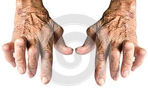 Rheumatoid Arthritis