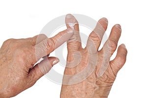 Rheumatoid arthritis of the fingers. Using medical cream photo