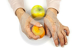 Rheumatoid arthritis hands and fruits