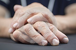 Rheumatoid Arthritis hands photo