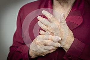 Rheumatoid arthritis hands photo