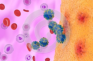 CAR T cell therapy in Rheumatoid arthritis - isometric view 3d illustration photo