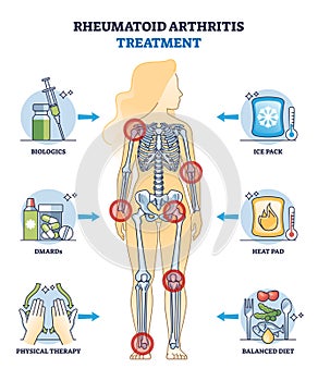 Rheumatoid arthritis treatment and health therapy methods outline diagram photo