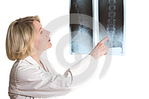 Rheumatologist showing lumbar vertebra