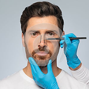 Rhinoplasty concept. Handsome middle aged man with marking on his nose standing on grey background, closeup, cropped