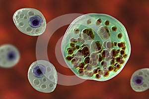 Rhinosporidium seeberi parasite, the causative agent of rhinosporidiosis, disease with formation of polypoidal masses in