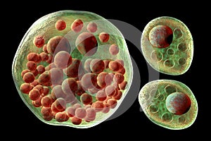 Rhinosporidium seeberi parasite, the causative agent of rhinosporidiosis, disease with formation of polypoidal masses in