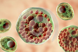 Rhinosporidium seeberi parasite, the causative agent of rhinosporidiosis, disease with formation of polypoidal masses in