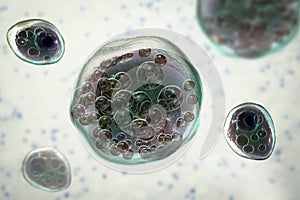 Rhinosporidium seeberi parasite, the causative agent of rhinosporidiosis, disease with formation of polypoidal masses in