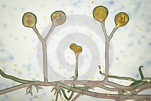 Rhizomucor fungi, 3D illustration. Filamentous fungi commonly found in soil, the causative agent of mucormycosis in