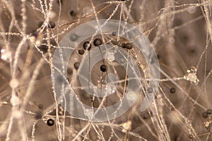 Rhizopus bread mold under the microscope.