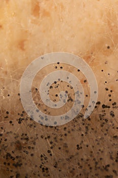 Rhizopus bread mold under the microscope.