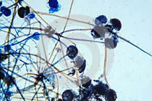 Rhizopus bread mold under the microscope