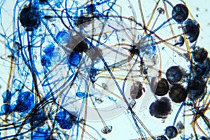 Rhizopus bread mold under the microscope