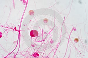 Rhizopus bread mold under the microscope