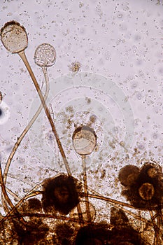 Rhizopus is a genus of common saprophytic fungi on Slide under the microscope for education.