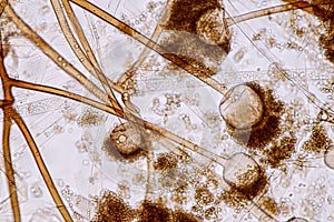 Rhizopus is a genus of common saprophytic fungi on Slide under the microscope for education.