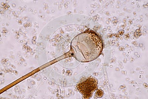 Rhizopus is a genus of common saprophytic fungi on Slide under the microscope for education.