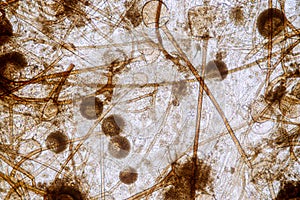 Rhizopus is a genus of common saprophytic fungi on Slide under the microscope for education. photo