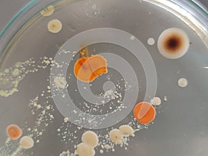 Rhodotorula candida and other fungi and bacteria