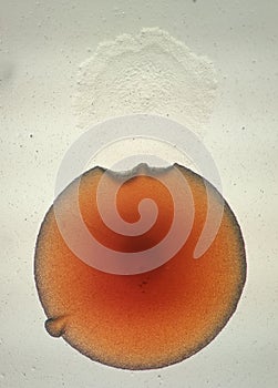 Rhodotorula colony under the microscope