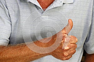 Right Hand Thumbs Up of a Mature Adult Caucasian Males Fingers