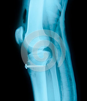 Right knee joint and Medical equipment X-ray