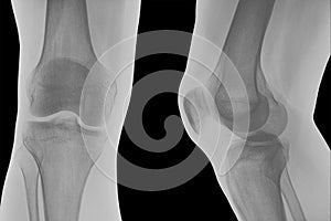 Right knee x-ray.