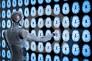 Robot analyze x-ray brain