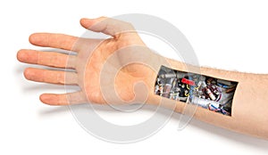 Robot hand inside human hand - Prosthesis concept