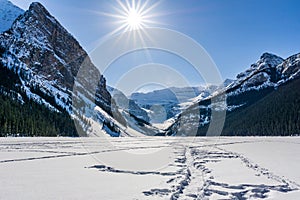 rocky mountains around frozen lake louise winter wonderland