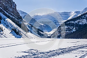 rocky mountains around frozen lake louise winter wonderland