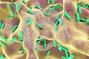 Rod-shaped bacteria inside bone tissue