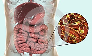 Rod-shaped bacteria Shigella which cause food-borne infection shigellosis or dysentery