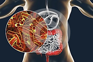 Rod-shaped bacteria Shigella which cause food-borne infection shigellosis or dysentery