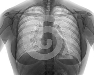 Roentgenogram img