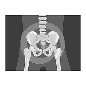 Roentgenograph of Coxofemoral Joint Front View Vector Image photo
