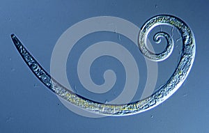 rolled up nematode in a drop of water
