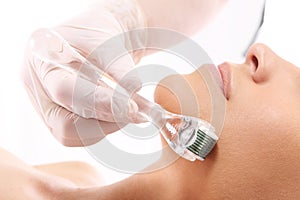 Roller microneedle mesotherapy photo