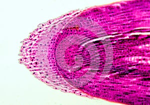 Root apex - microscopic view photo