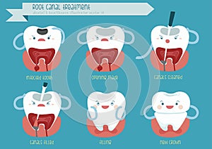 Root canal treatment photo